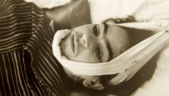 This 1940 photo -- not included in the exhibition -- shows KKahlo getting medical treatment. Provided by Sotheby ' s, itsshows Kahlo with her head suspended by straps. The image is part of a collection of photographs by Nicholas Muray up that was up for auction in 2019.